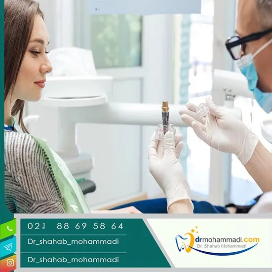 بهترین متخصص ایمپلنت را چگونه انتخاب کنیم؟